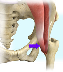 Hip Trauma Reconstruction